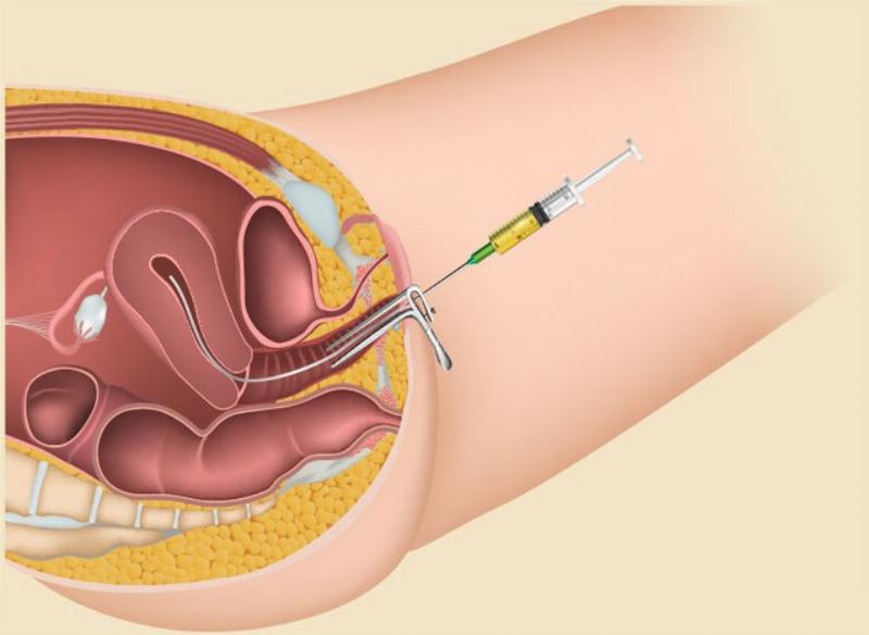 Hinh anh minh hoa chat luong trung quan trong voi kha nang thu thai tu nhien va ivf